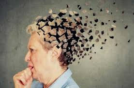 Enfermedad de Alzheimer
